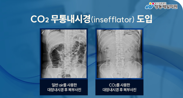 2019년 2월 CO2 insufflator 도입